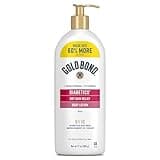 Gold Bond Diabetics' Dry Skin Relief Body Lotion With Vitamin E & Aloe To Soothe & Moisturize Dry, Flaky & Rough Skin, Value Size, 21 oz.