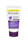 AmLactin KP Bumps Be Gone - 3 oz Keratosis Pilaris Moisturizing Cream with 15% Lactic Acid - Exfoliator and Moisturizer for Dry, Rough and Bumpy Skin (Packaging May Vary)