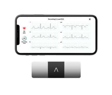 AliveCor KardiaMobile 6-Lead Personal EKG Monitor – Six Views of The Heart – Detects AFib and Irregular Arrhythmias – Instant Results in 30 Seconds – Works with Most Smartphones