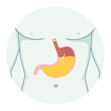 Acid Reflux Treatment & Symptoms | Request prescription for acid reflux medicine, heartburn relief, antacids from an online doctor, NP, or PA