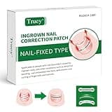 Truey Titanium Alloy Silicone Ingrown Toenail Treatment, correction patch, Ingrown Toenail Corrector, Nail correction tool,Ingrown Toenail Removal Kit,Cuttable Applicable for any nail size,Reusable