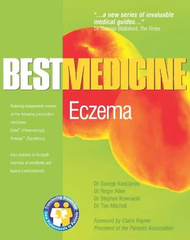 Eczema : Best Medicine for Eczema