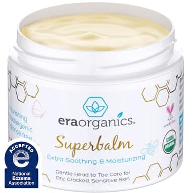 Era Organics Healing Ointment for Babies - USDA Certified Organic Natural Moisturizer Gentle on Sensitive Skin Prone To Baby Eczema, Cradle Cap (Infant Seborrheic Dermatitis), Rashes, Hives and More