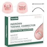 Dual Nitinol Ingrown Toenail Corrector,Ingrown Toenail Treatment,Curved Toenail Straightener,Ingrown Toe Nail Relief,Ingrown Toenail Removal Kit,Big Toe Ingrown Toenail Tool (0.55in,0.66in)
