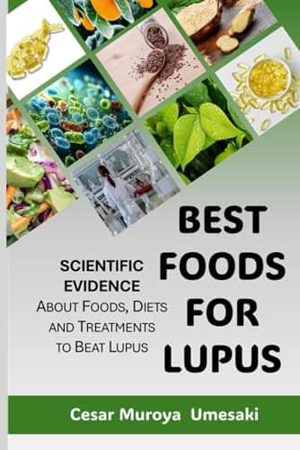 BEST FOODS FOR LUPUS: What to eat when you have Lupus?.... A compilation of scientific research explained for everyone. (SCIENCE vs LUPUS: Scientific ... on Diet, Inflammation, Treatments, and More)