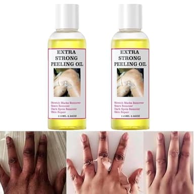 Yellow Peeling Oil for Dark Skin, Extra Strong Peeling Oil, Natural Formula Exfoliating Peels Solution for Face, Body, Hands and Foot Dead Skin Remover (220ML/7.76 OZ)