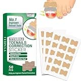 Ingrown Toenail Treatment,50 Pcs No Glue Breathable Corrector Patch,Painless ingrown toenail corrector,nail correction patches,Not easy to fall off, quick repair Ingrown Nail Treatment Tool, toenail