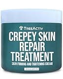 TreeActiv Crepey Skin Repair Treatment, 8oz, Firming Cream with Hyaluronic Acid & Shea Butter to Deeply Moisturize & Tighten Wrinkly Dry Crepe Skin, 500+ Uses