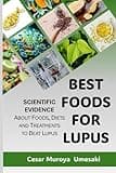 BEST FOODS FOR LUPUS: What to eat when you have Lupus?.... A compilation of scientific research explained for everyone. (SCIENCE vs LUPUS: Scientific ... on Diet, Inflammation, Treatments, and More)