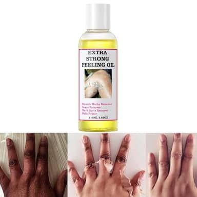 Generic Extra Strong Yellow Peeling Oil for Dark Skin - Exfoliating Solution for Body, Hand, Feet and Face - All Skin Types (110ML/3.88 Fl Oz)