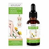 Varicose Veins Essential Oil, Spider Vein Removal Oil for Legs, Natural Varicose Veins Oils 30ML