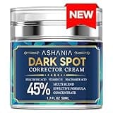 Dark Spot Remover for Face and Body: Dark Spot Remover - Melasma, Freckle, Sun Spot, Age Spot Remover Advanced Formula with Niacinamide for Women and Men(1.7 Fl Oz)
