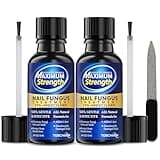 Toenail Fungus Treatment with 25% Undecylenic Acid, Toe Fungus Treatment for Toenail, Fungus Nail Treatment, Toenail Fungus Treatment Extra Strength, Fungal Nail Treatment for Athletes Foot (1oz)