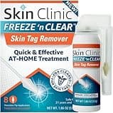 Skin Clinic FREEZE 'n CLEAR Skintag Remover - Cryogenic Kit (8 - Applicators + Tweezers), Freezing Tag Treatment Solution for Adults
