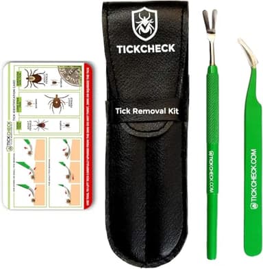 TickCheck Premium Tick Remover Kit - Stainless Steel Tick Remover + Tweezers, Leather Case, and Free Pocket Tick Identification Card (1 Set)