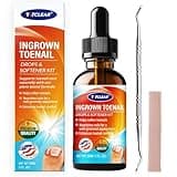Ingrown Toenail Drops: Ingrown Toenail Tool for Men Women - Big Toe Ingrown Nail Tool - Ingrown Toenail Removal Kit - Ingrown Toenails Softener Kit with Toe Caps - Ingrown Toenails Solution - 30ml