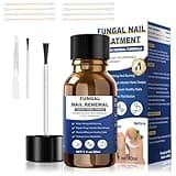 Toenail Fungus Treatment Extra Strength,Fungus Nail Treatment,Nail Fungus Treatment For Toenail,Athletes Foot Treatment,Ingrown Toenail Treatment,Toe Nail Fungus Treatments For Fungi Nail(1fl oz/30ml)
