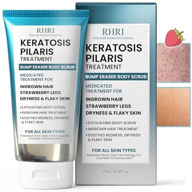 KP Bump Eraser Body Scrub with 10% AHA | Keratosis Pilaris Treatment | Bump Eraser Body Scrub | Ingrown Hair Treatment | Clears Strawberry Legs | Soothes Redness, Dryness & Flaky Skin