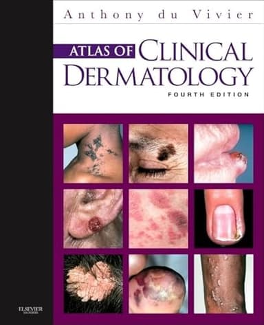 Atlas of Clinical Dermatology (du Vivier, Atlas of Clinical Dermatology)